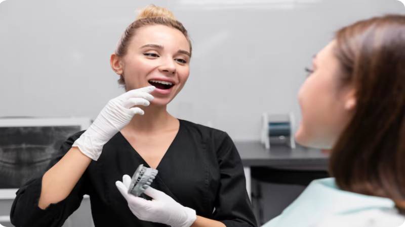 Veneers